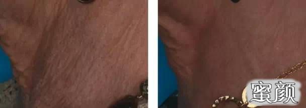 https://img.miyanlife.com/mnt/timg/210103/1555593C6-2.jpg
