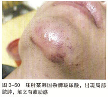 https://img.miyanlife.com/mnt/timg/210103/163505KF-3.jpg