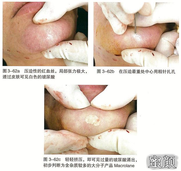 https://img.miyanlife.com/mnt/timg/210103/1635112S0-5.jpg