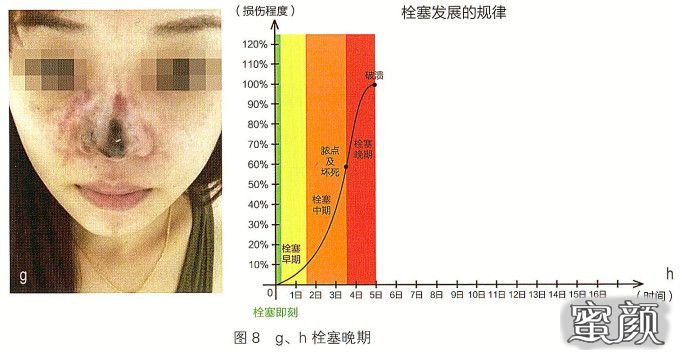 案例图片