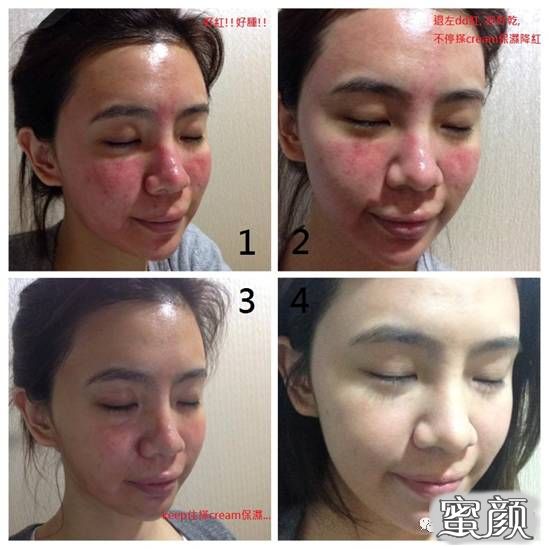 https://img.miyanlife.com/mnt/timg/210105/1044525a2-6.jpg