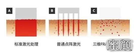 案例图片