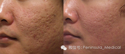 https://img.miyanlife.com/mnt/timg/210105/14550913b-7.jpg