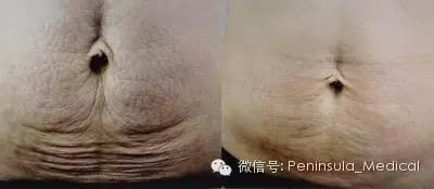 https://img.miyanlife.com/mnt/timg/210105/14550934V-8.jpg