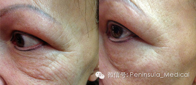 https://img.miyanlife.com/mnt/timg/210105/1455094044-5.jpg