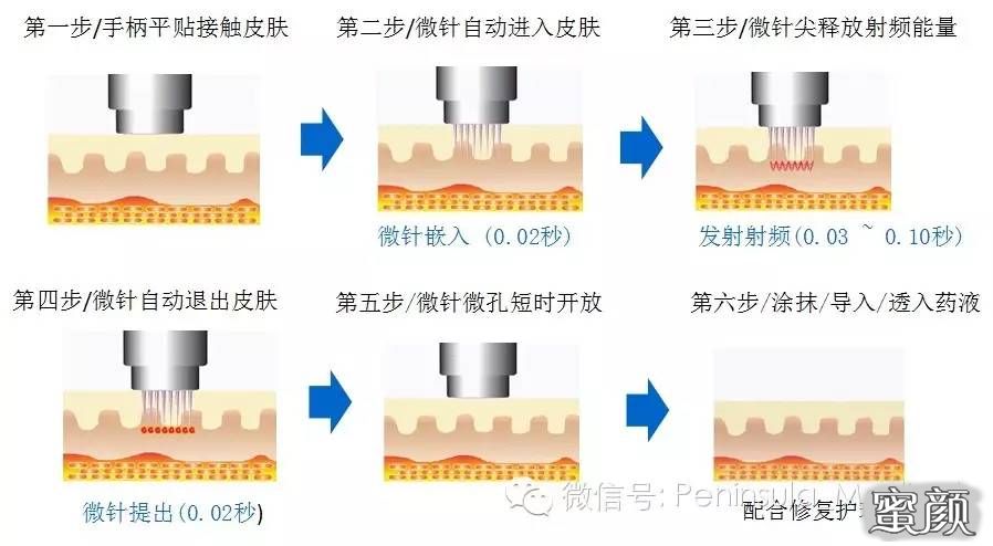 https://img.miyanlife.com/mnt/timg/210105/14550SC5-3.jpg