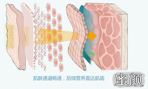 https://img.miyanlife.com/mnt/timg/210105/1Q94LB5-0.jpg