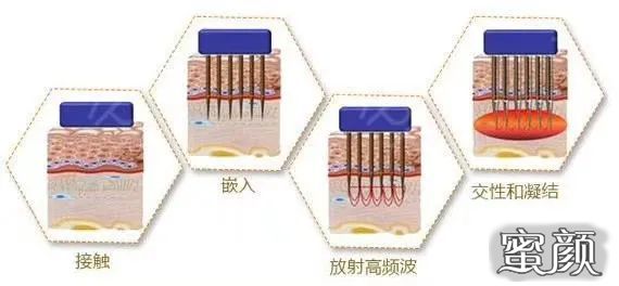 https://img.miyanlife.com/mnt/timg/210105/2143455N4-1.jpg