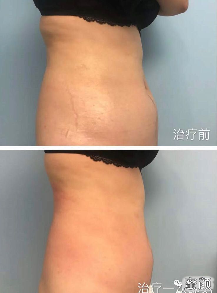https://img.miyanlife.com/mnt/timg/210106/0950552U7-4.jpg