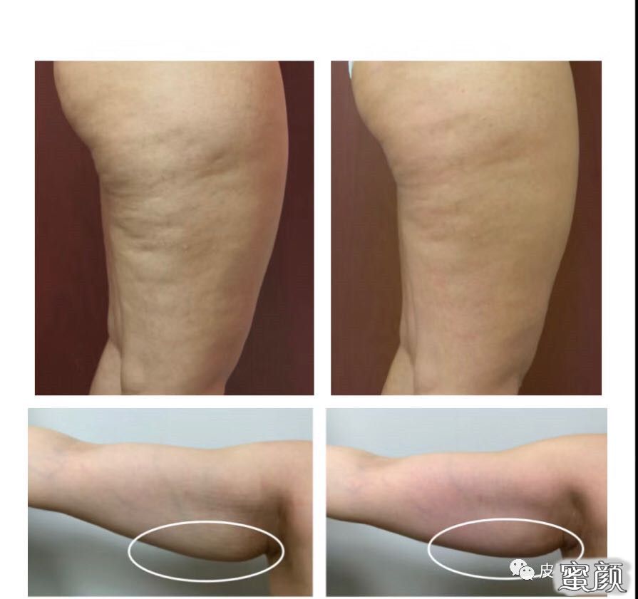 https://img.miyanlife.com/mnt/timg/210106/09505TL1-5.jpg