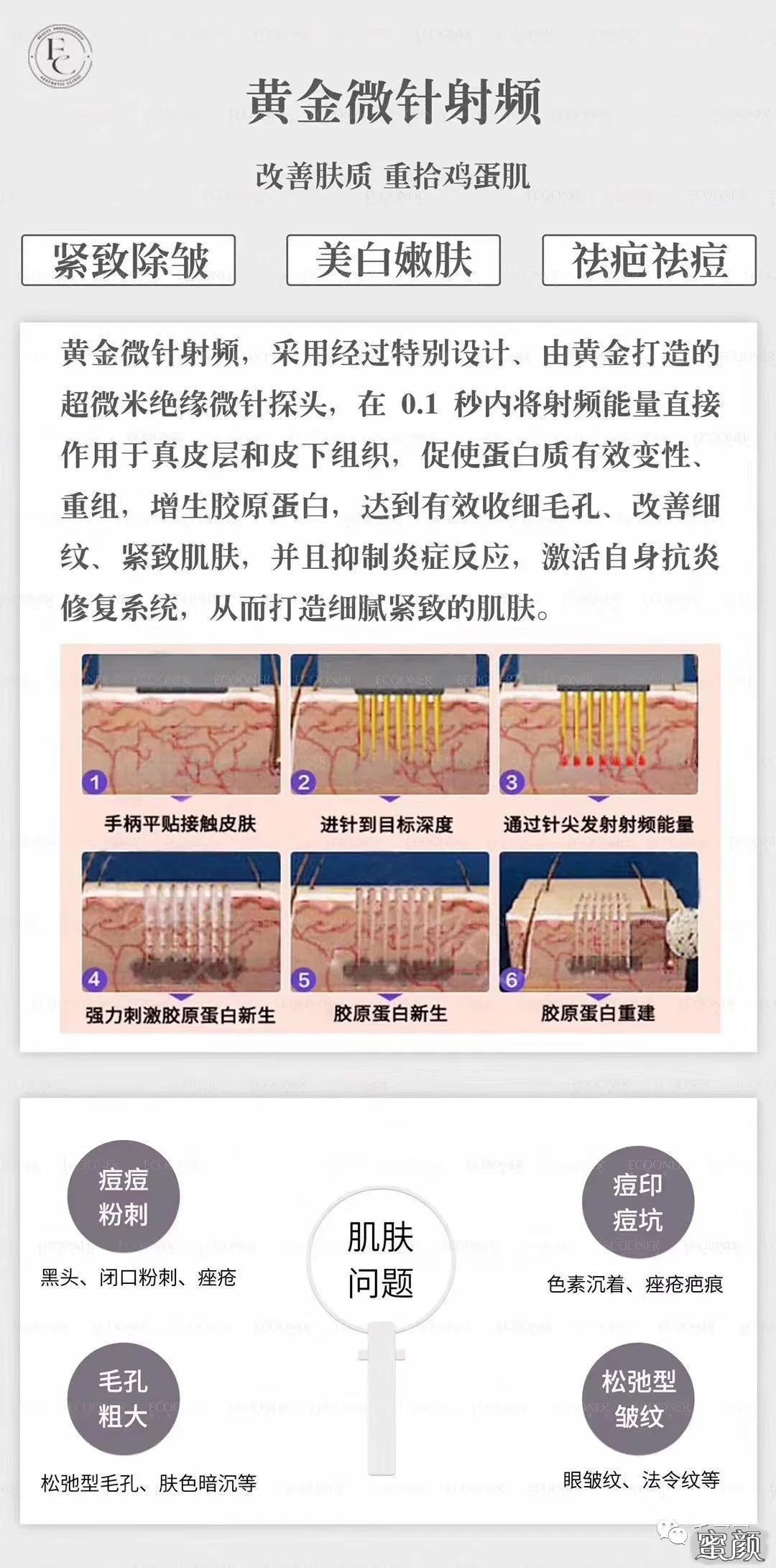 https://img.miyanlife.com/mnt/timg/210106/1622292355-1.jpg