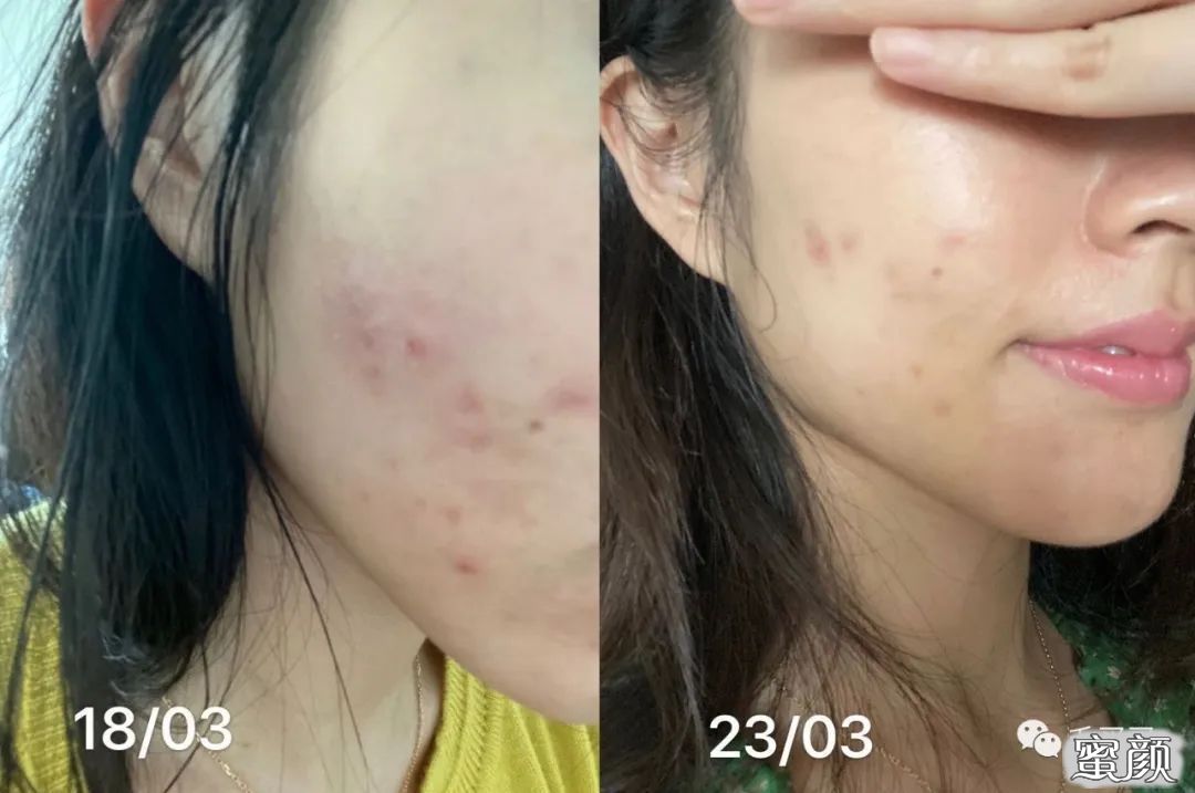 https://img.miyanlife.com/mnt/timg/210106/1622312619-3.jpg