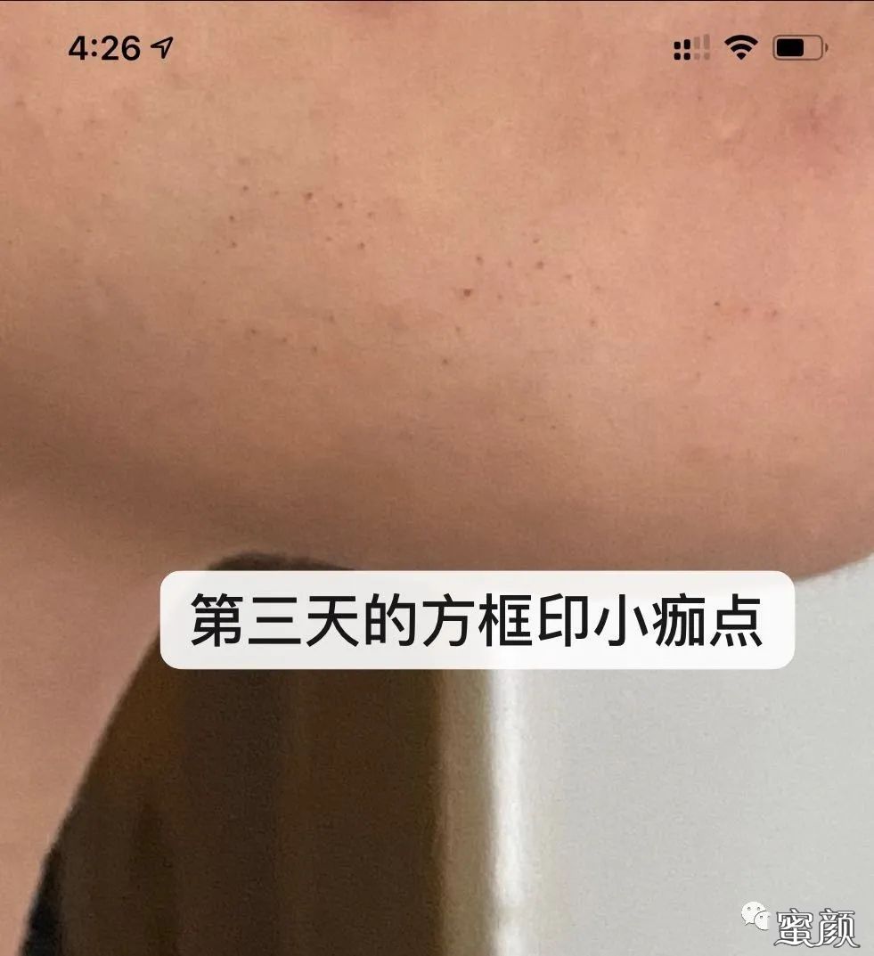 https://img.miyanlife.com/mnt/timg/210106/1622342347-5.jpg
