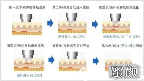 案例图片