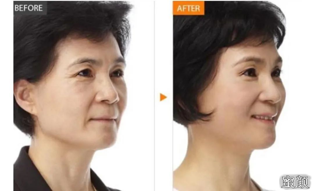 https://img.miyanlife.com/mnt/timg/210110/140Q22D3-3.jpg