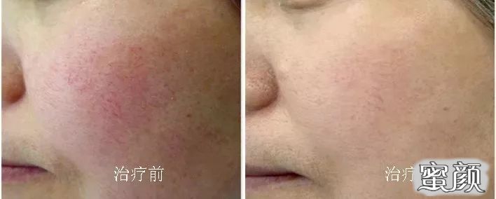 https://img.miyanlife.com/mnt/timg/210112/1300491534-4.jpg