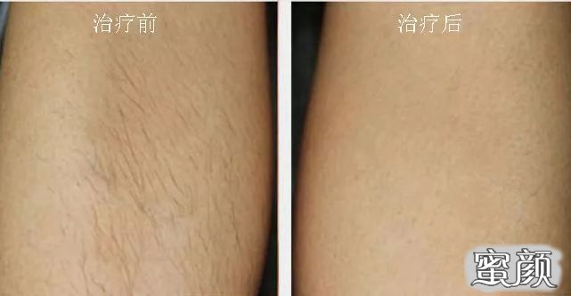 https://img.miyanlife.com/mnt/timg/210112/1300513O5-10.jpg