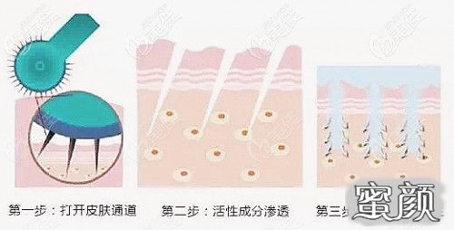 https://img.miyanlife.com/mnt/timg/210112/150K53911-2.jpg