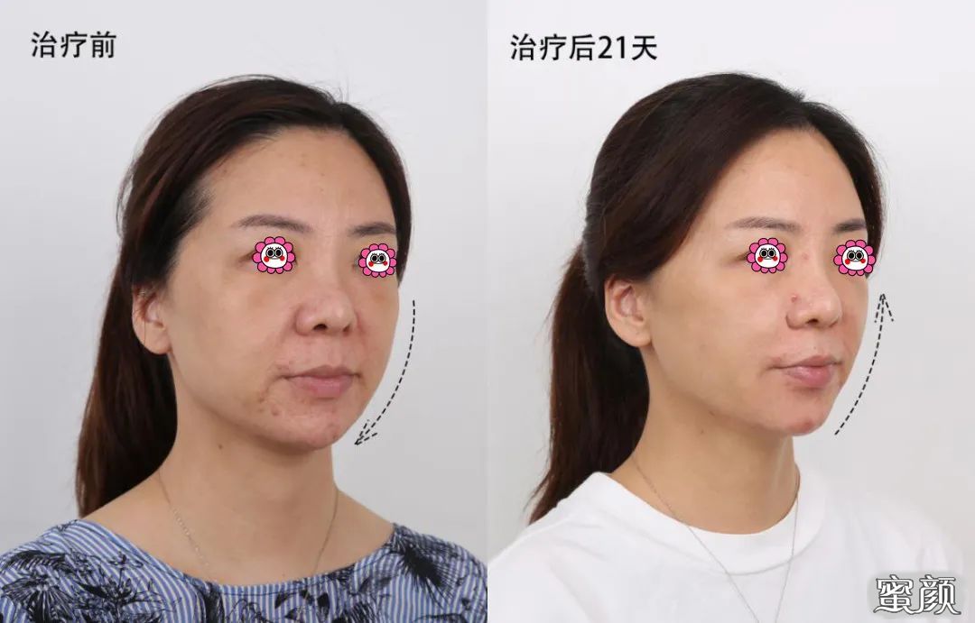 https://img.miyanlife.com/mnt/timg/210113/202A945C-1.jpg