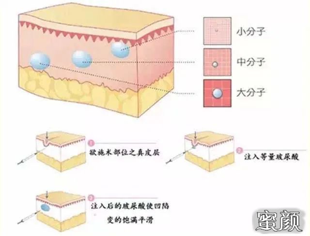 案例图片