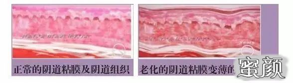 https://img.miyanlife.com/mnt/timg/210117/14105V920-0.jpg