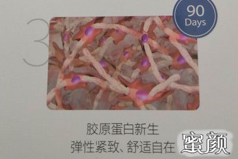 https://img.miyanlife.com/mnt/timg/210117/1411033046-5.jpg