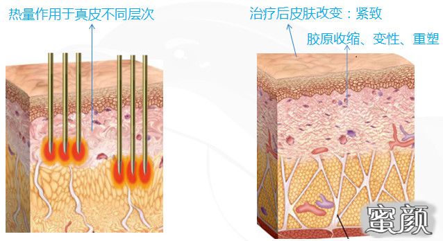 https://img.miyanlife.com/mnt/timg/210118/143925N53-10.jpg