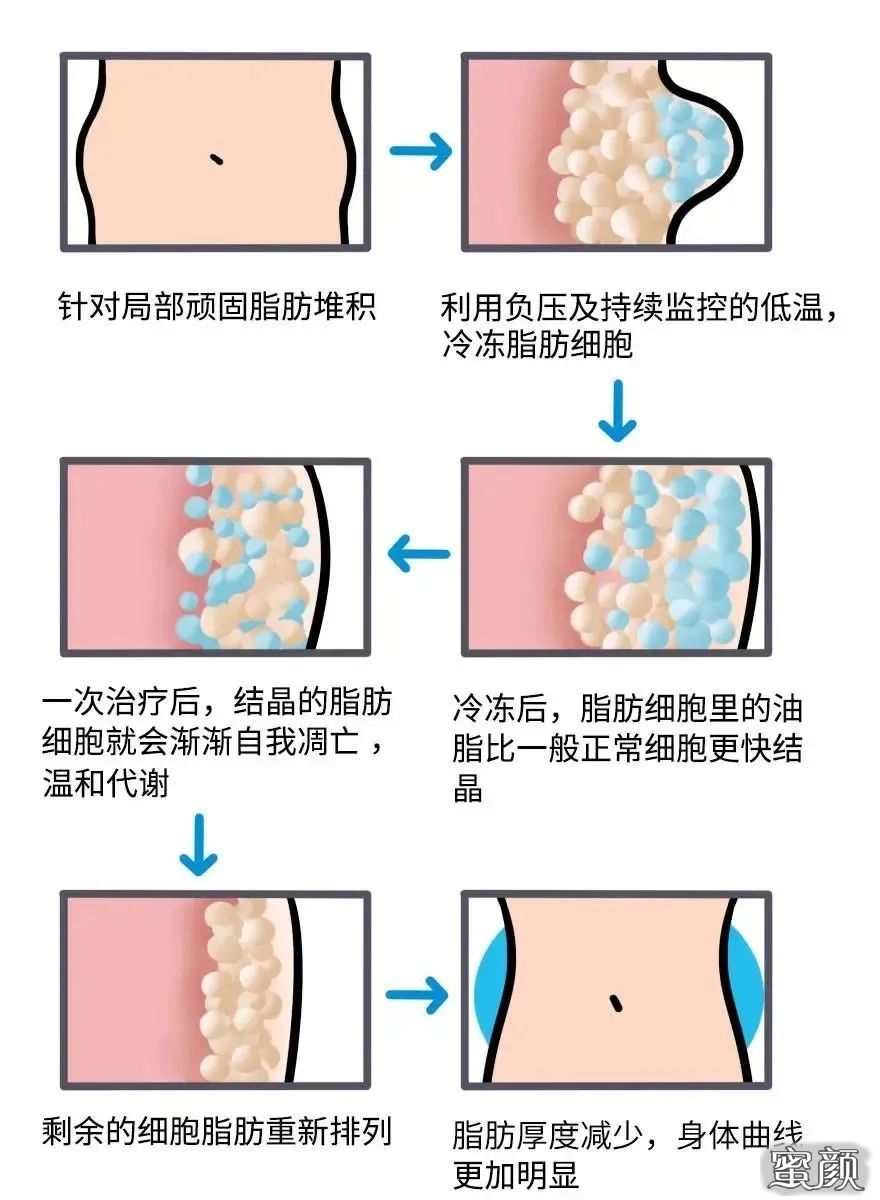 https://img.miyanlife.com/mnt/timg/210118/143AR406-1.jpg