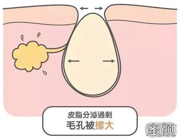 https://img.miyanlife.com/mnt/timg/210118/143UV3Y-7.jpg