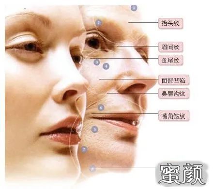 https://img.miyanlife.com/mnt/timg/210118/23325K104-0.jpg