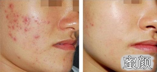 https://img.miyanlife.com/mnt/timg/210120/144FG218-4.jpg