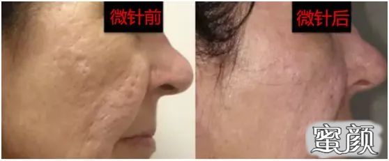 https://img.miyanlife.com/mnt/timg/210120/144FS138-5.jpg
