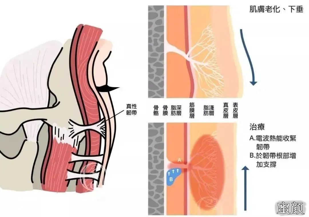 https://img.miyanlife.com/mnt/timg/210121/12394JK4-6.jpg