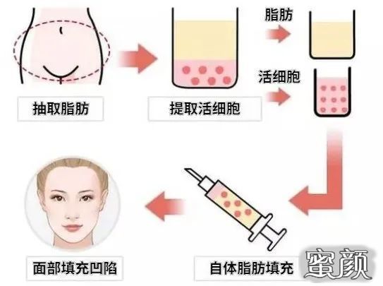 https://img.miyanlife.com/mnt/timg/210122/0PSI244-1.jpg