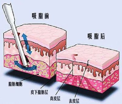 案例图片