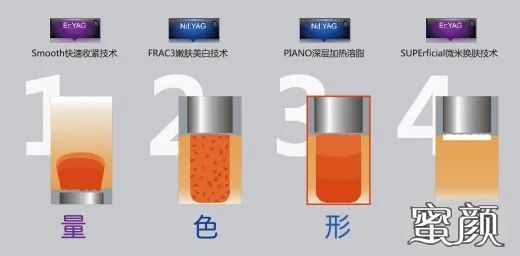 https://img.miyanlife.com/mnt/timg/210124/161344FS-6.jpg