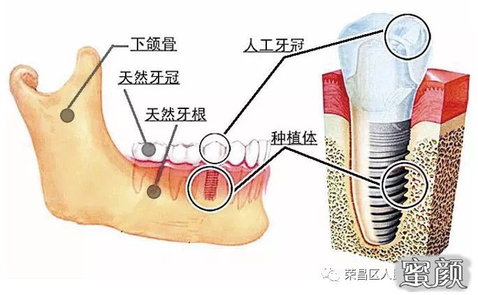 案例图片