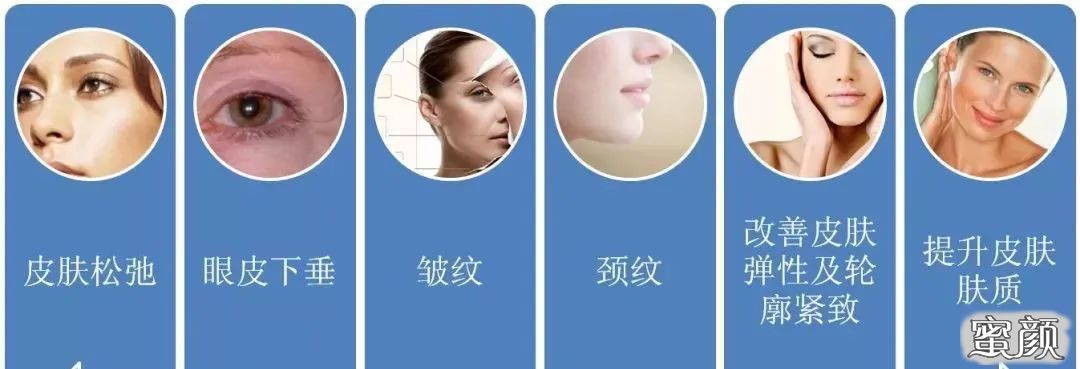 https://img.miyanlife.com/mnt/timg/210124/202S34110-4.jpg