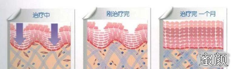 https://img.miyanlife.com/mnt/timg/210124/202S3O93-3.jpg