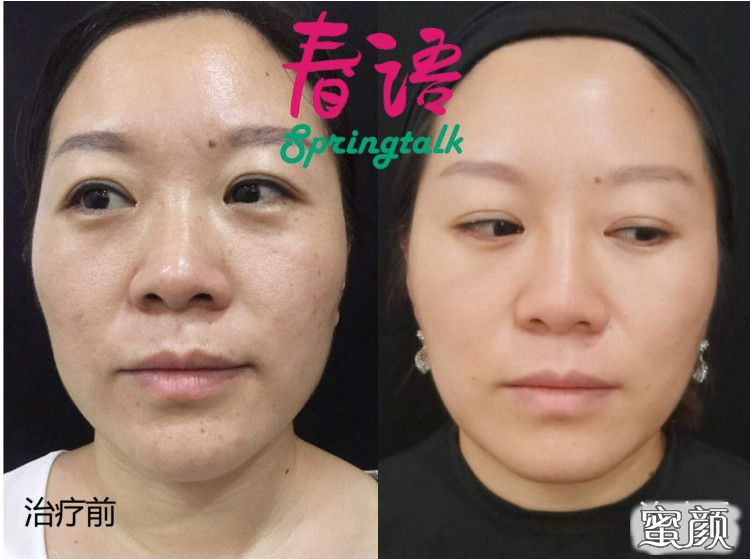 https://img.miyanlife.com/mnt/timg/210128/1625353T1-10.jpg