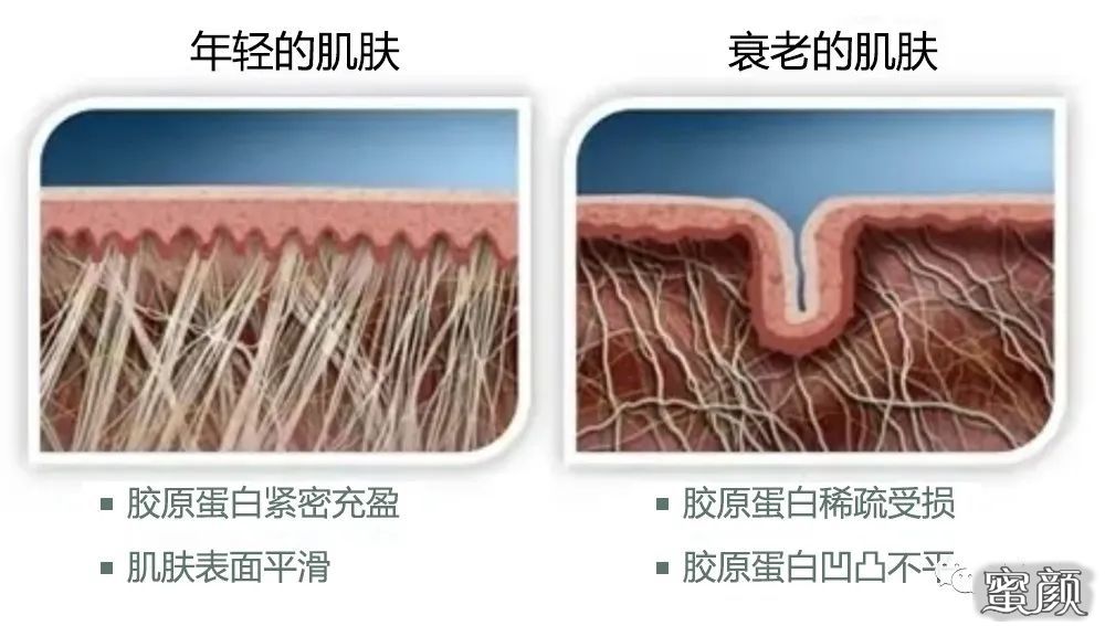 案例图片