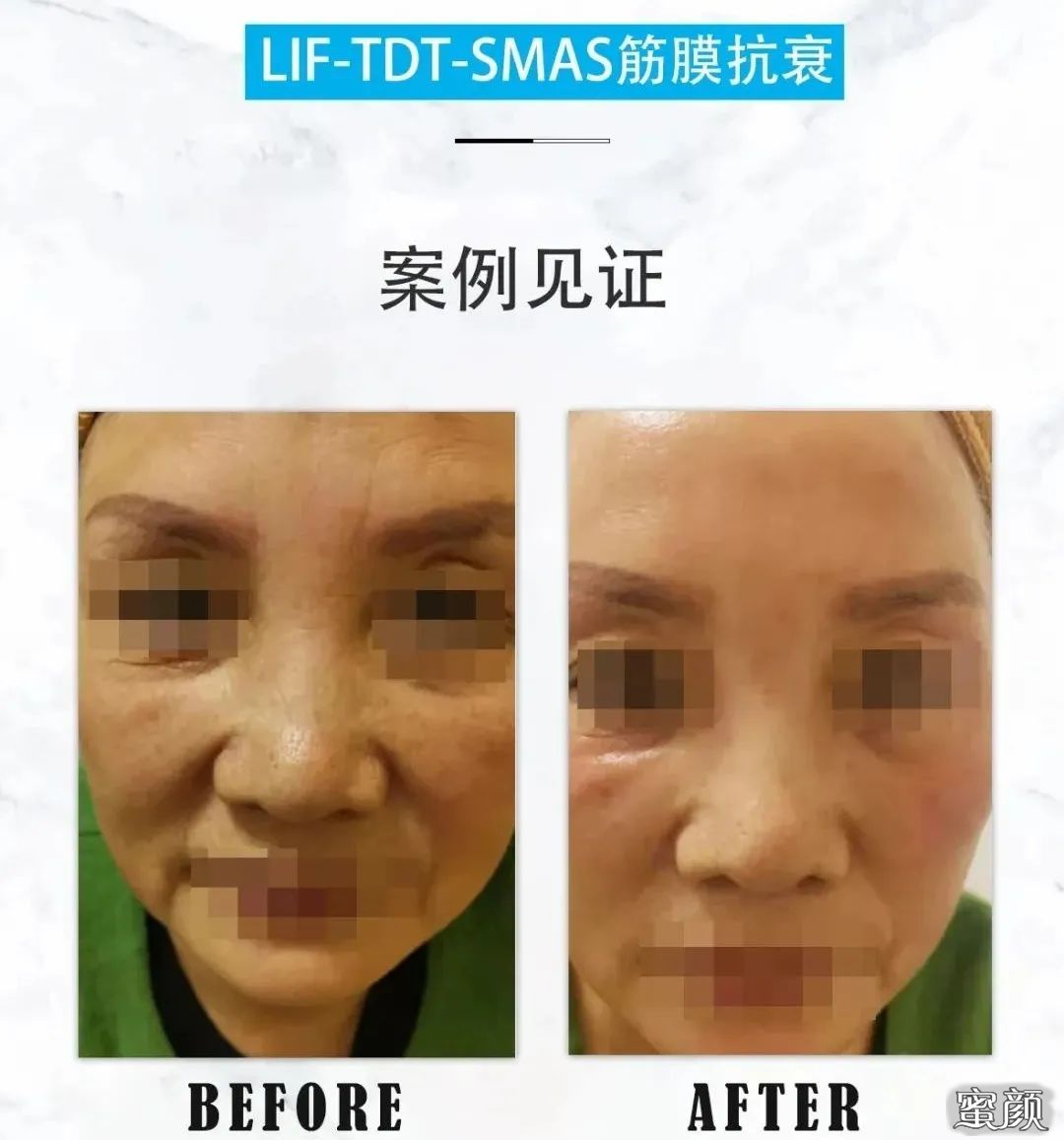 https://img.miyanlife.com/mnt/timg/210129/210421K16-0.jpg