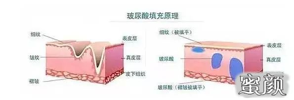 https://img.miyanlife.com/mnt/timg/210130/1914493T2-6.jpg