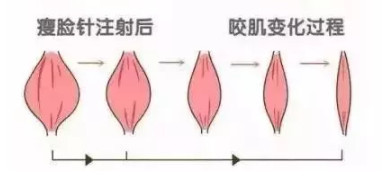 https://img.miyanlife.com/mnt/timg/210130/19144T294-4.jpg