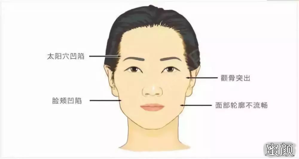 https://img.miyanlife.com/mnt/timg/210131/15225433G-2.jpg