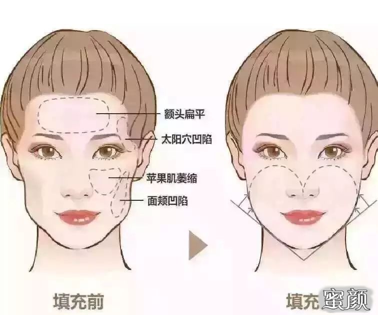 https://img.miyanlife.com/mnt/timg/210131/15230R606-7.jpg