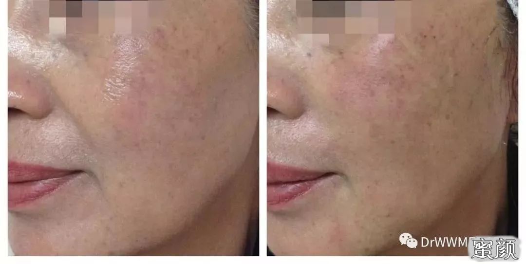 https://img.miyanlife.com/mnt/timg/210131/1Z60G420-2.jpg