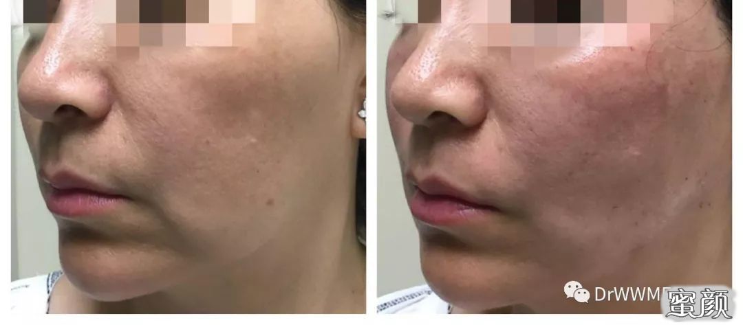 https://img.miyanlife.com/mnt/timg/210131/1Z60UV6-5.jpg