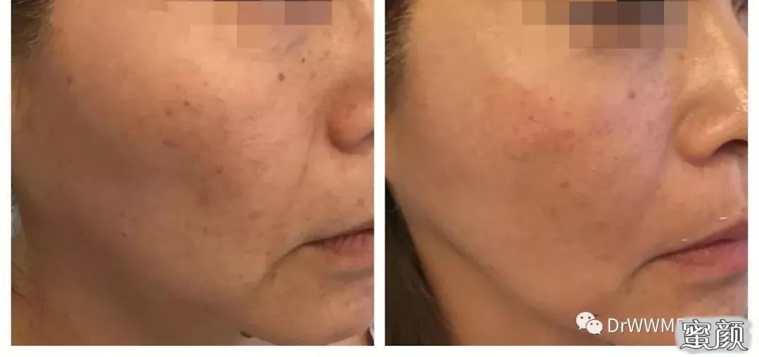 https://img.miyanlife.com/mnt/timg/210131/1Z60aG9-7.jpg