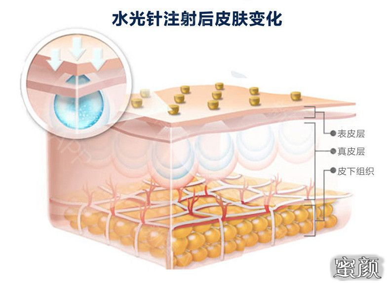 案例图片